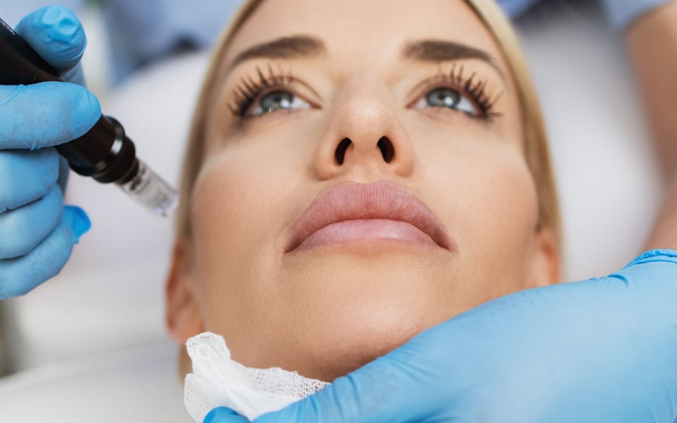 Microneedling Services in Bedford